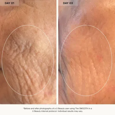 U Beauty The Smooth Dynamic Wrinkle Defense Serum Anti-aging Serum 30ml In Transparent