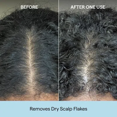 Briogeo Scalp Revival Charcoal + Coconut Oil Micro-exfoliating Scalp Scrub Shampoo 32 oz/ 936 ml In 8 Fl oz