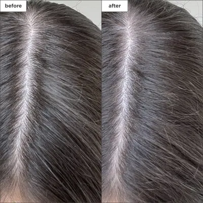 Briogeo Dnu Low Msrp  Unisex 1.7oz Scalp Revival Charcoal+biotin Shampoo In Default Title