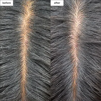 Briogeo Scalp Revival Charcoal + Tea Tree Cooling Hydration Mask For Dry, Itchy Scalp 6 oz/ 177 ml In Default Title