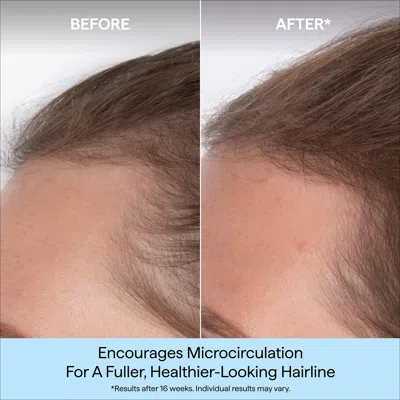 Briogeo Destined For Density™ Megastrength+ Caffeine + Biotin Peptide Density Serum In Transparent