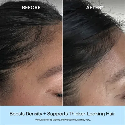 Briogeo Destined For Density™ Megastrength+ Caffeine + Biotin Peptide Density Serum In Transparent