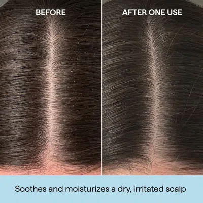 Briogeo Scalp Revival Rosemary Pre-wash Scalp And Hair Oil 3.4 Fl. Oz. / 100 ml In Default Title