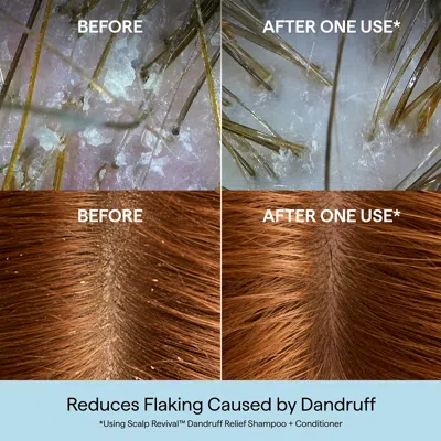 Briogeo Scalp Revival Dandruff Relief Shampoo With Salicylic Acid 8.4 Fl Oz/248 ml In Transparent