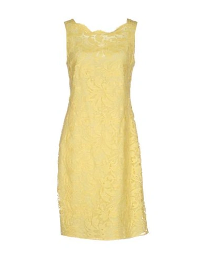 Emilio Pucci Short Dress In Yellow