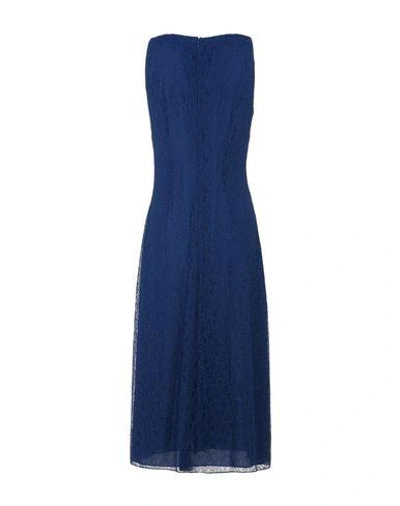 Shop Tory Burch 3/4 Length Dresses In Blue