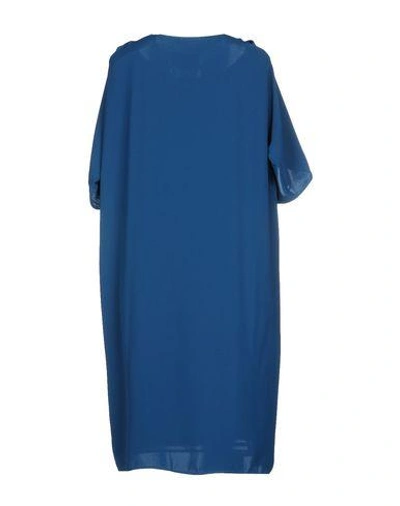 Shop Maison Margiela Short Dress In Pastel Blue