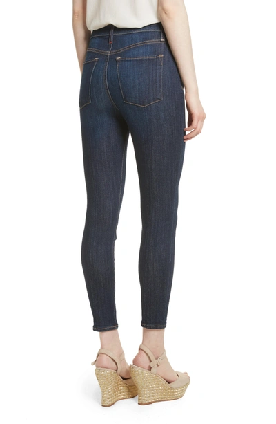 Shop Ao.la Ao. La Good High Waist Exposed Button Skinny Jeans In Dream On