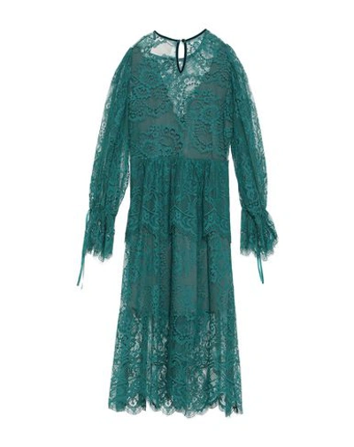 Shop Aniye By Woman Midi Dress Deep Jade Size L Polyamide In Green