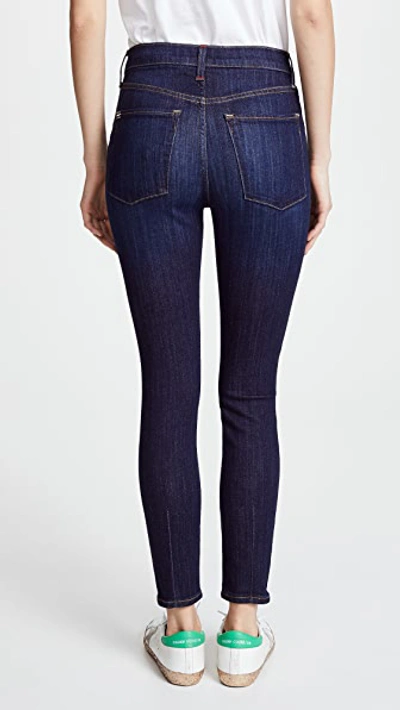 High Rise Exposed Button Jeans