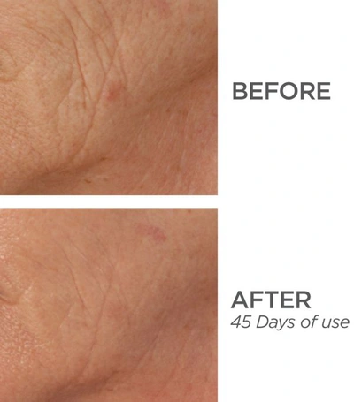 Shop Beautybio R45 The Reversal 3-phase Skin Transforming Treatment In White