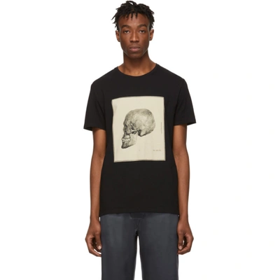 Alexander Mcqueen Anatomical Skull-print Cotton T-shirt In Black