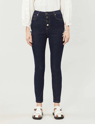 Ted Baker Leppie Button-detail Straight High-rise Jeans In Navy