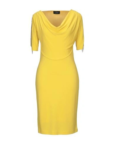 Clips Knee-length Dress In Yellow