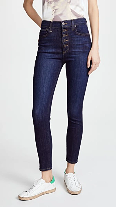 Ao.la High Rise Exposed Button Jeans In Dream On