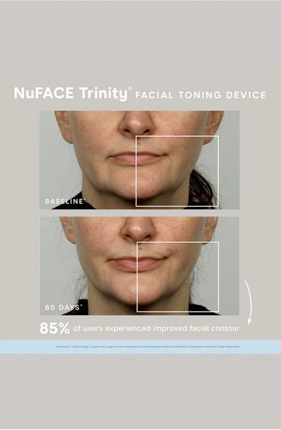 Nuface ® Certified Refreshed Trinity Smart Advanced Facial Toning Device Set Usd $259 Value In Platinum