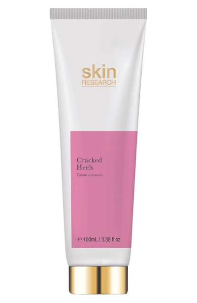 Skin Research Cracked Heels Treatment In White